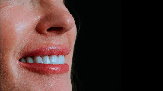 Implantes Modernos: Precisão, Estética e Confiança.