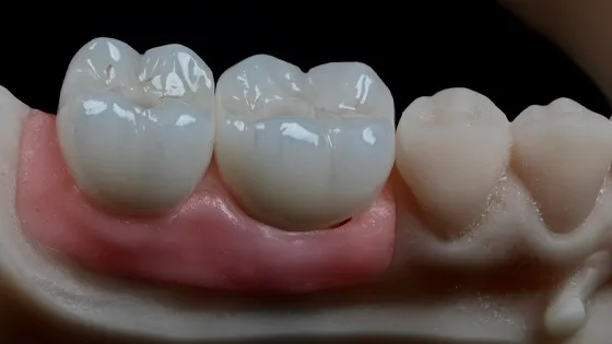 O Rigor Clínico do Padrão Internacional